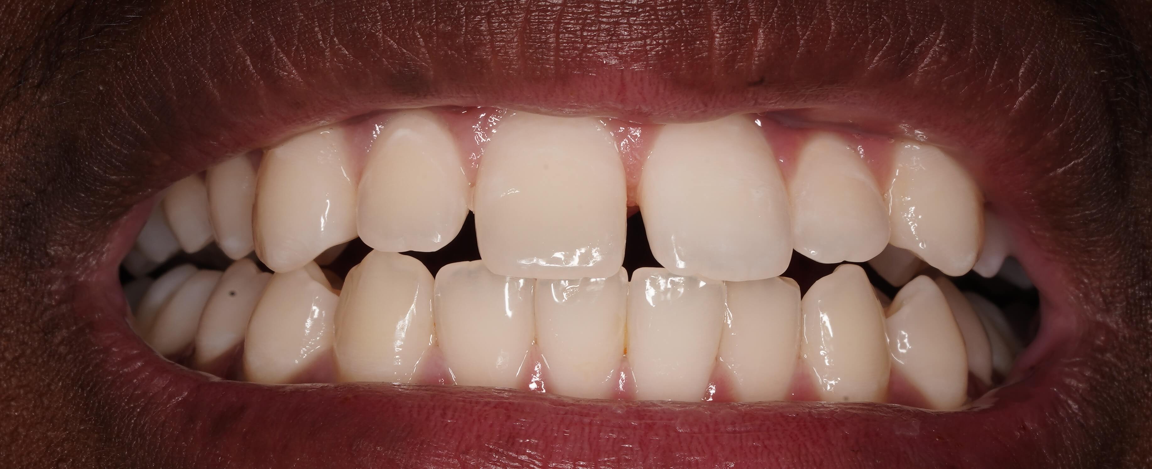 Before treatment
